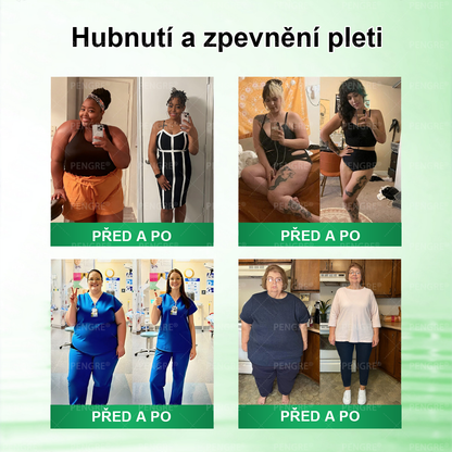 𝐀𝐍𝐆𝐄𝐋𝐓𝐑𝐀𝐏® 🎁 NEUVĚŘITELNÁ NABÍDKA! ✨ ZÍSKEJTE DNES TÉMĚŘ ZDARMA – 𝟓𝟎% SLEVA! ⏳🔥